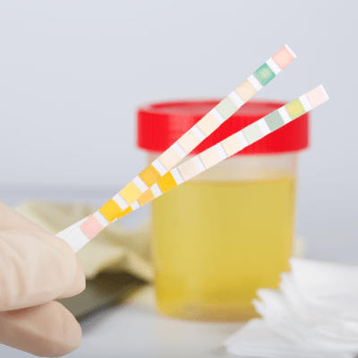 MOBILE DRUG TESTING